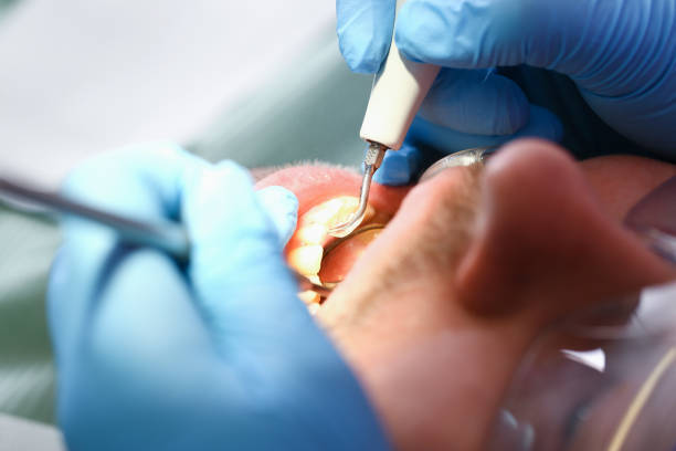 Best Urgent Tooth Repair  in Black River, NY